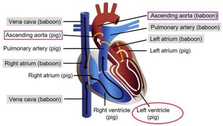 Are pig hearts used in humans?
