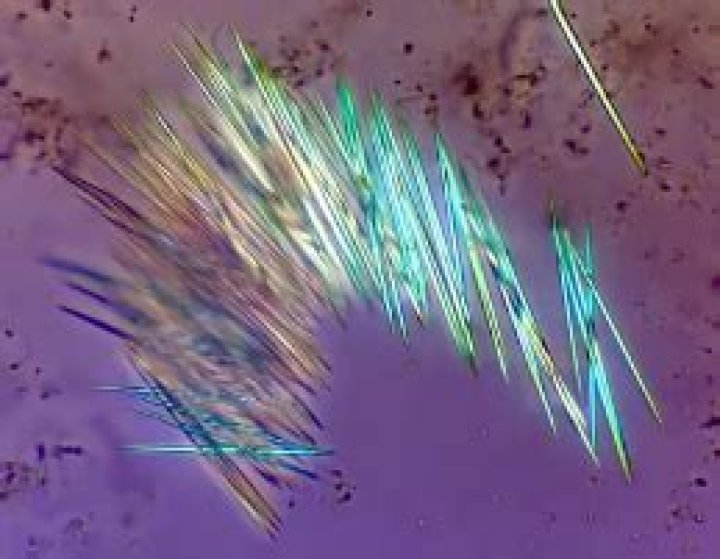 Are there needles in Euphoria?