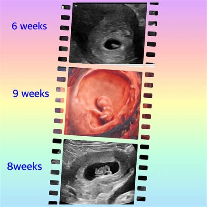 Can I do ultrasound at 4 weeks?