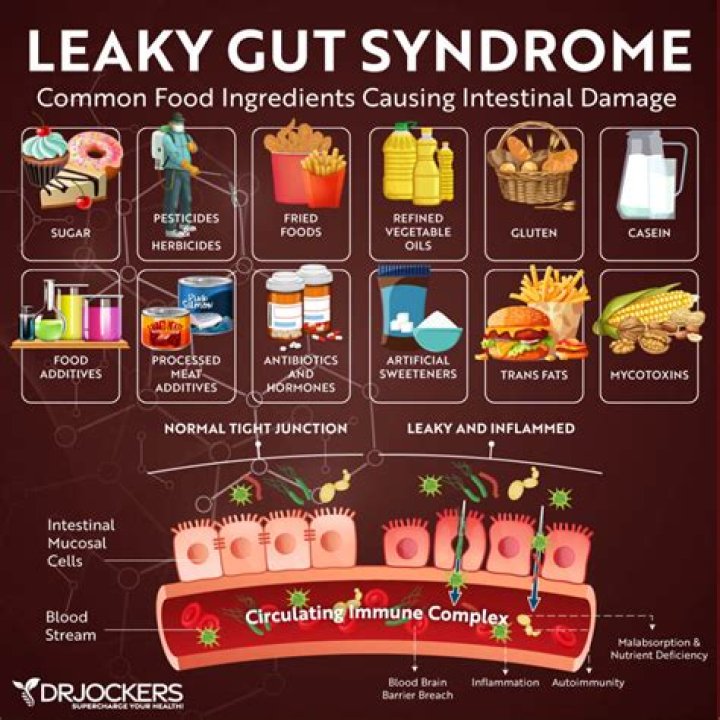 Can yogurt heal leaky gut?