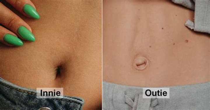 Can you change your outie to an innie?