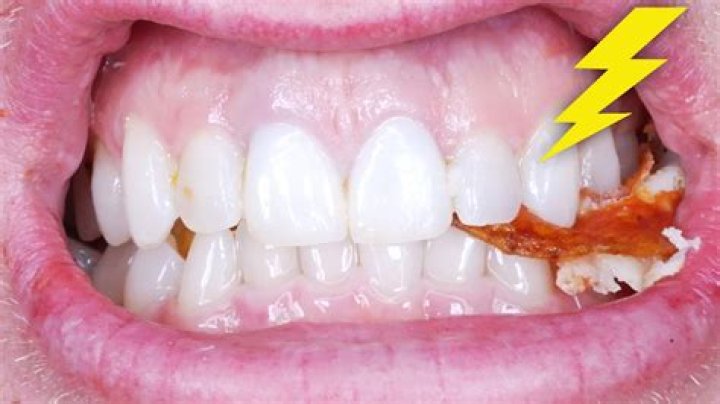 Can your teeth last a lifetime?