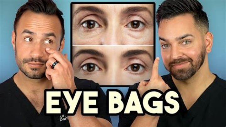 Do Eyebags make you look old?