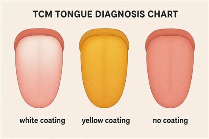 How do I get rid of yellow coating on my tongue?