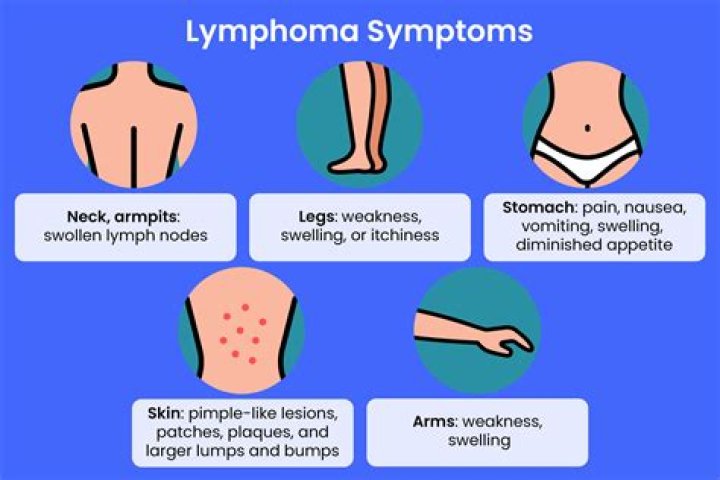 How do I know I don't have lymphoma?