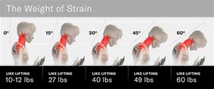 How do I stop my neck from looking old?