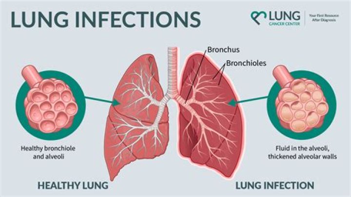 How do you know if lungs are damaged by COVID?