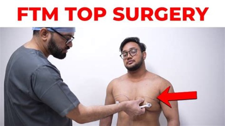 How is top surgery done?