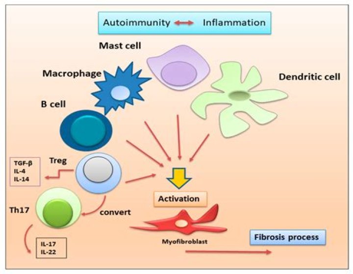 Is epilepsy an autoimmune disease?