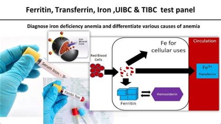 Is ferritin related to Covid?