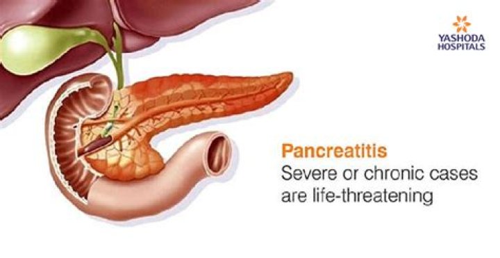 Is pancreatitis life threatening?