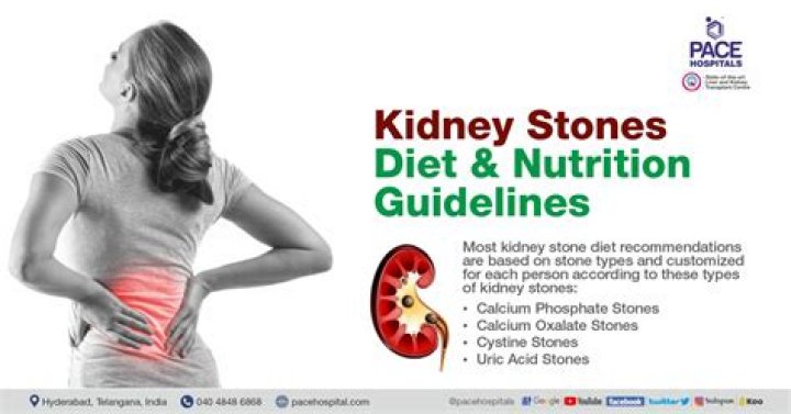 Is Sprite good for kidney stones?