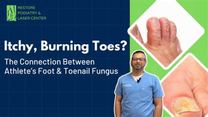 What causes fungus between toes?