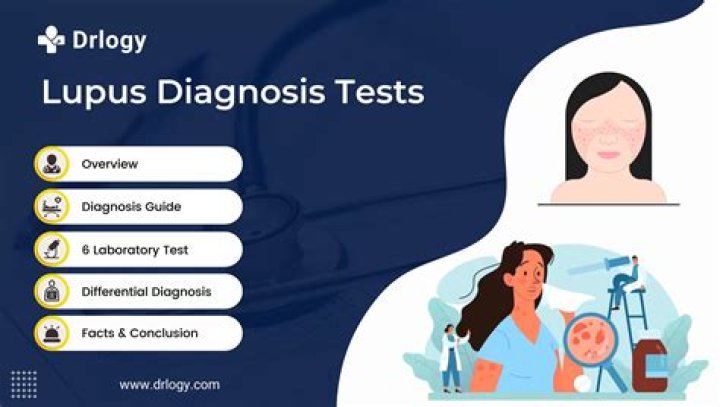 What does lupus do to a person?