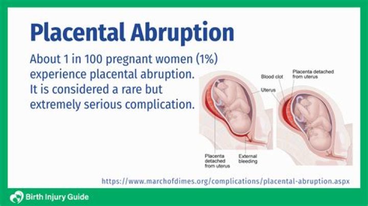 What happens to the placenta at birth?