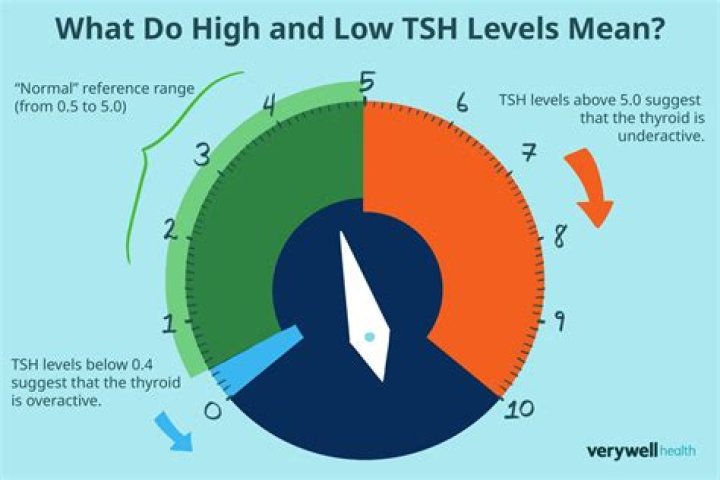 What is considered a high TSH level?