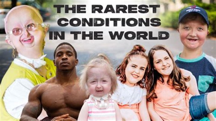 What is the rarest thing to be born with?