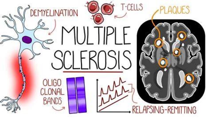 Which NASCAR driver has multiple sclerosis?