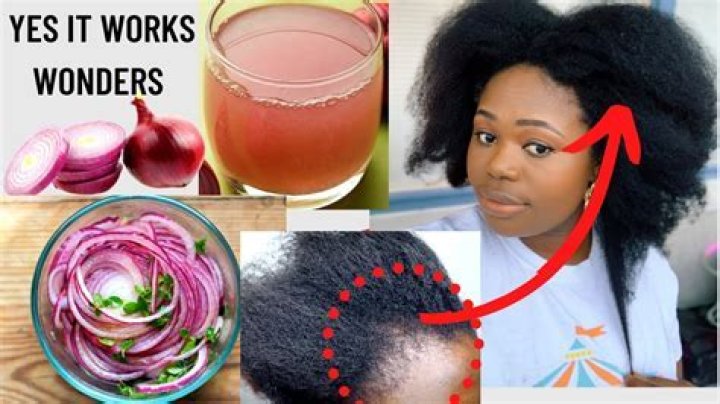 Which onion is best for hair?