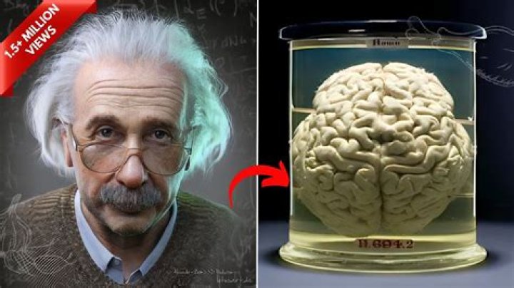 Who has Einstein's brain?