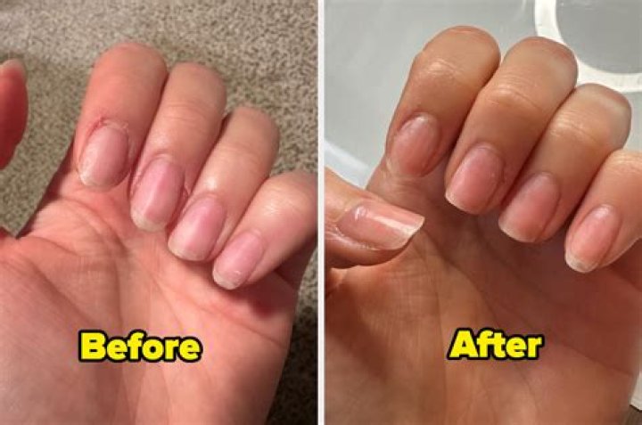 Why are my nails weak after shellac?