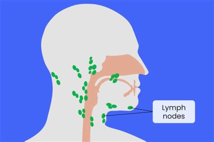 Why do my lymph nodes in neck hurt?