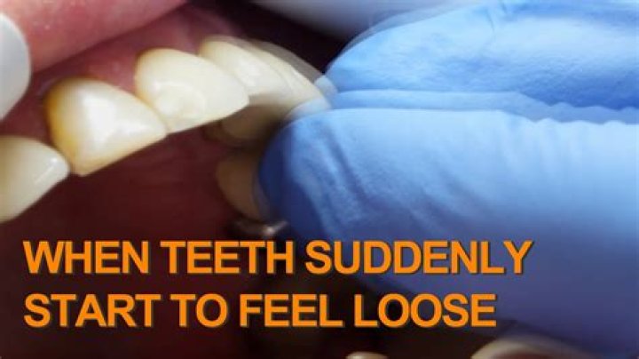 Why do my teeth feel loose after flossing?