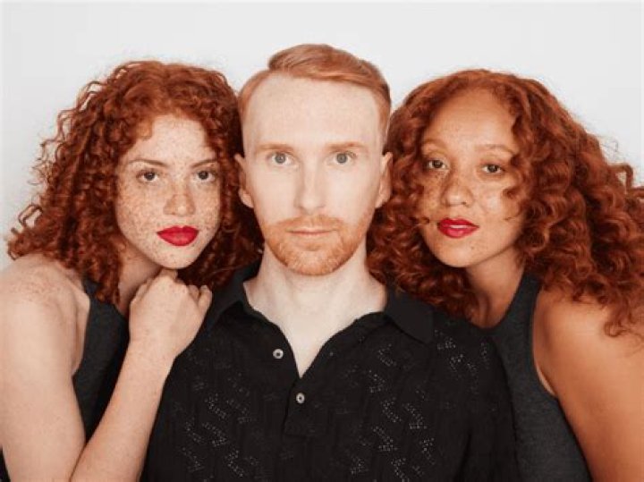 Why do some redheads not have freckles?