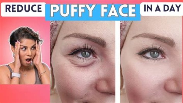 Why does face get puffy with age?