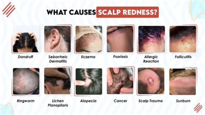 Why does my scalp hurt during chemo?