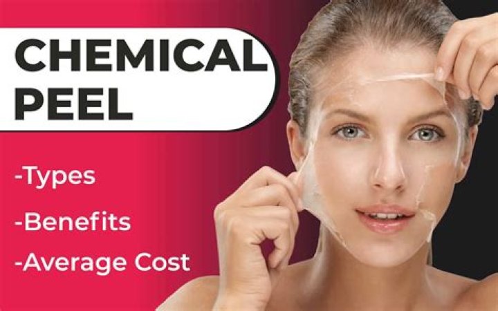 Why does Shellac peel off?