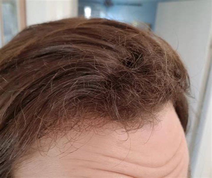 Why is my hair so fragile?